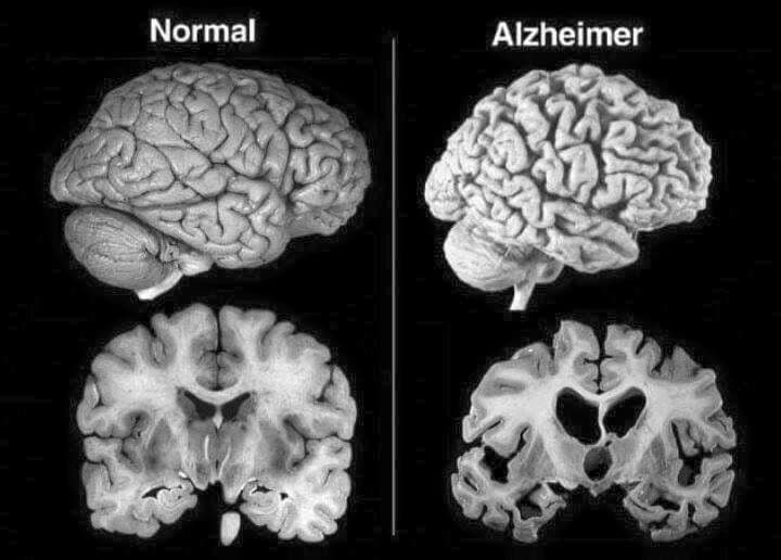 AlzCare